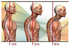 Slouch for 42 lb head position